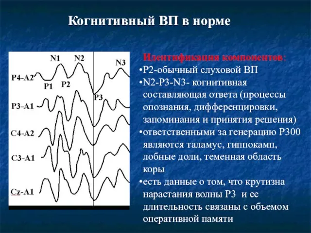 Когнитивный ВП в норме Идентификация компонентов: P2-обычный слуховой ВП N2-P3-N3- когнитивная составляющая