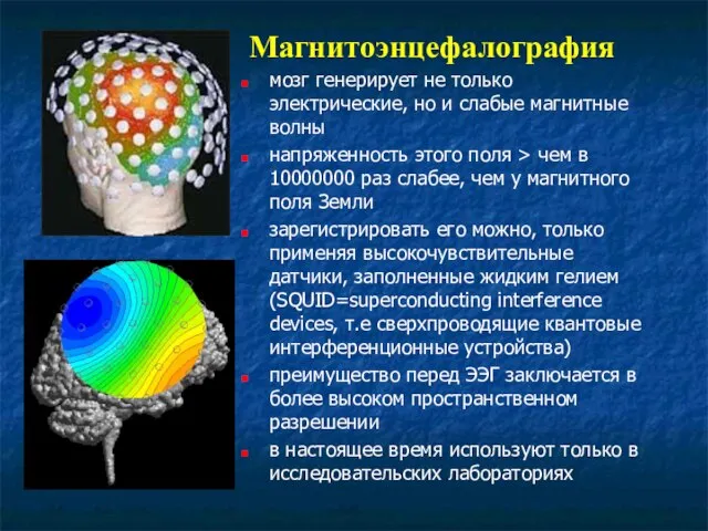 Магнитоэнцефалография мозг генерирует не только электрические, но и слабые магнитные волны напряженность