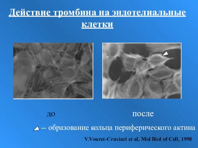 Действие тромбина на эндотелиальные клетки до после -- образование кольца периферического актина