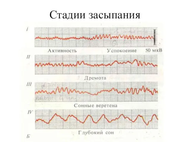 Стадии засыпания