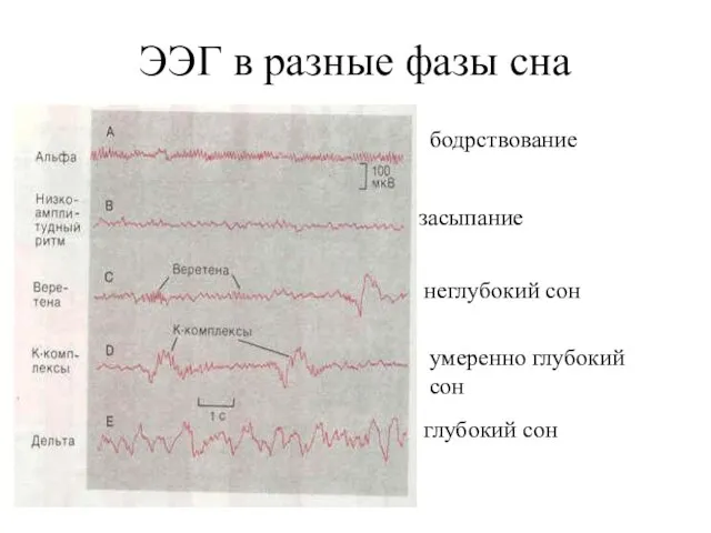 ЭЭГ в разные фазы сна бодрствование засыпание неглубокий сон умеренно глубокий сон глубокий сон