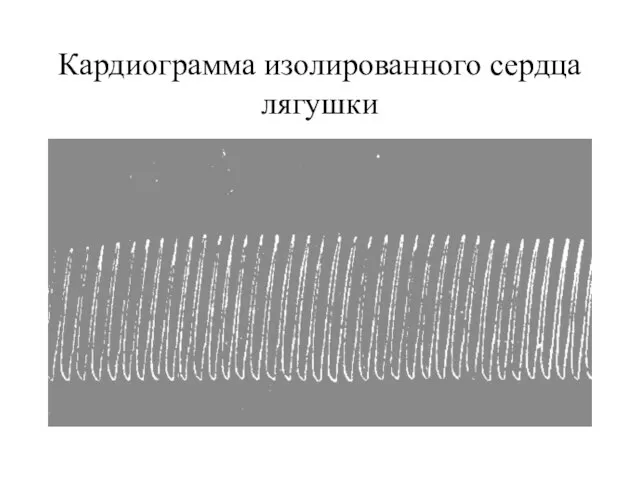 Кардиограмма изолированного сердца лягушки