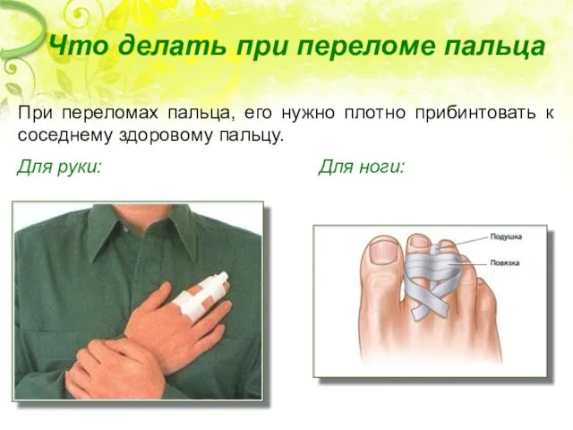 Что делать при переломе пальца При переломах пальца, его нужно плотно прибинтовать