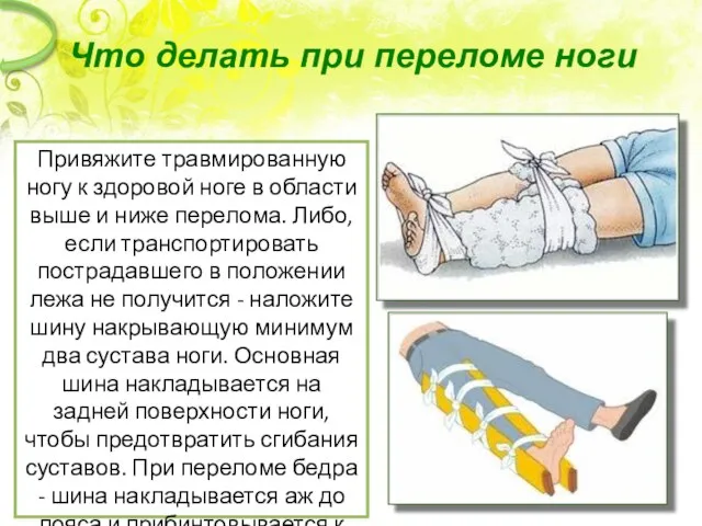 Что делать при переломе ноги Привяжите травмированную ногу к здоровой ноге в