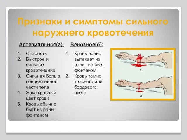 Признаки и симптомы сильного наружнего кровотечения Артериальное(а): Слабость Быстрое и сильное кровотечение