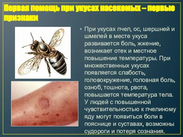 При укусах пчел, ос, шершней и шмелей в месте укуса развивается боль,
