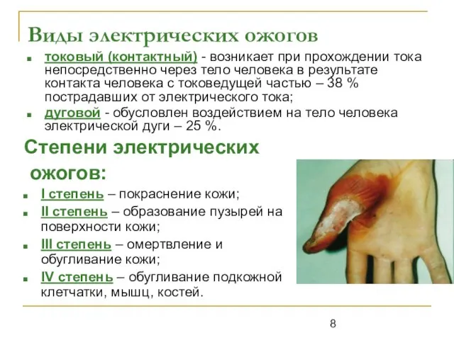 Виды электрических ожогов токовый (контактный) - возникает при прохождении тока непосредственно через