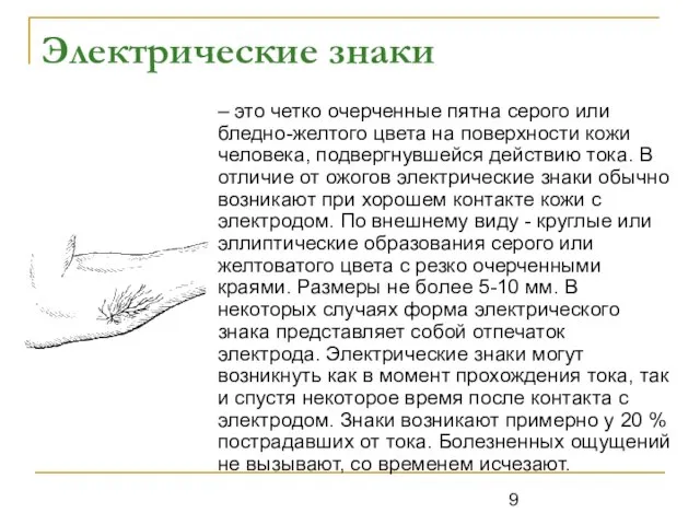 Электрические знаки – это четко очерченные пятна серого или бледно-желтого цвета на