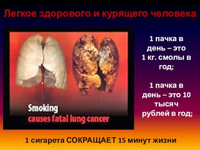 Легкое здорового и курящего человека 1 сигарета СОКРАЩАЕТ 15 минут жизни 1