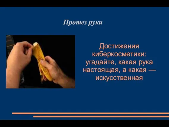 Достижения киберкосметики: угадайте, какая рука настоящая, а какая — искусственная Протез руки