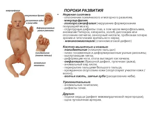 ПОРОКИ РАЗВИТИЯ Нервная система: - отклонения психического и моторного развития; - микроцефалия;