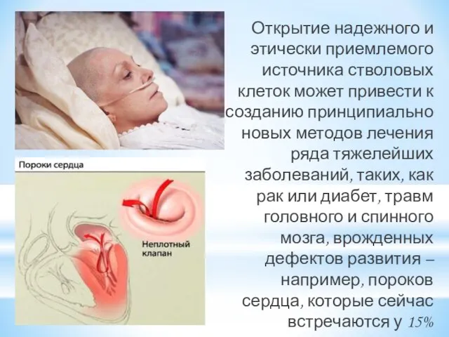 Открытие надежного и этически приемлемого источника стволовых клеток может привести к созданию