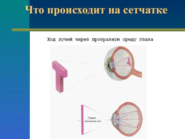 Что происходит на сетчатке