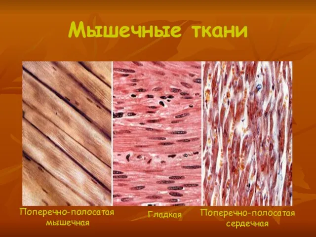 Мышечные ткани Поперечно-полосатая мышечная Гладкая Поперечно-полосатая сердечная