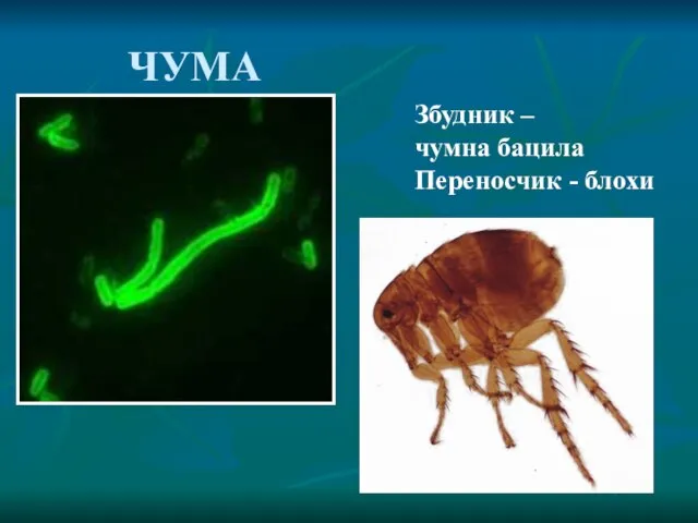 ЧУМА Збудник – чумна бацила Переносчик - блохи