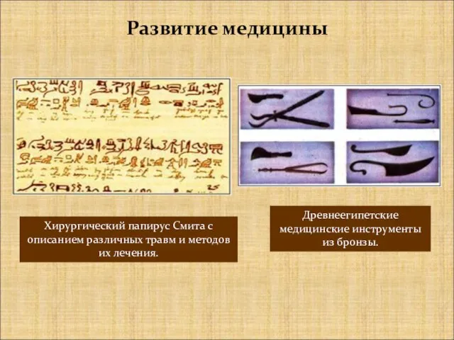 Древнеегипетские медицинские инструменты из бронзы. Развитие медицины Хирургический папирус Смита с описанием
