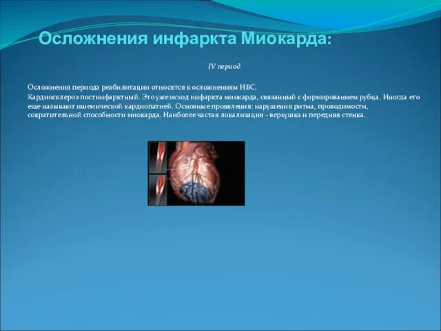 Осложнения инфаркта Миокарда: IV период Осложнения периода реабилитации относятся к осложнениям ИБС.