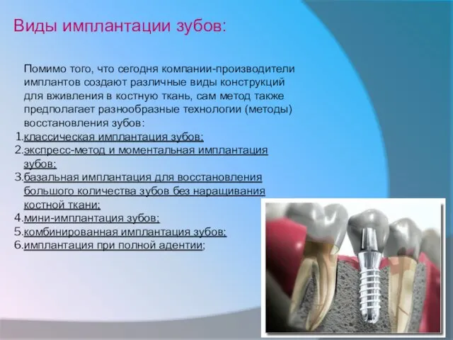 Помимо того, что сегодня компании-производители имплантов создают различные виды конструкций для вживления