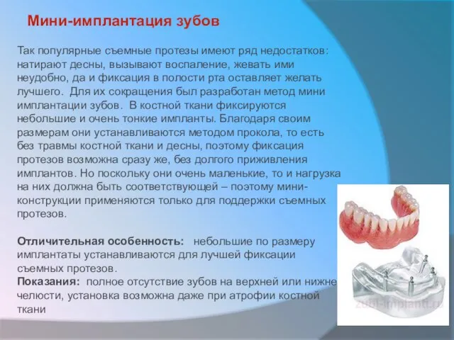 Мини-имплантация зубов Так популярные съемные протезы имеют ряд недостатков: натирают десны, вызывают