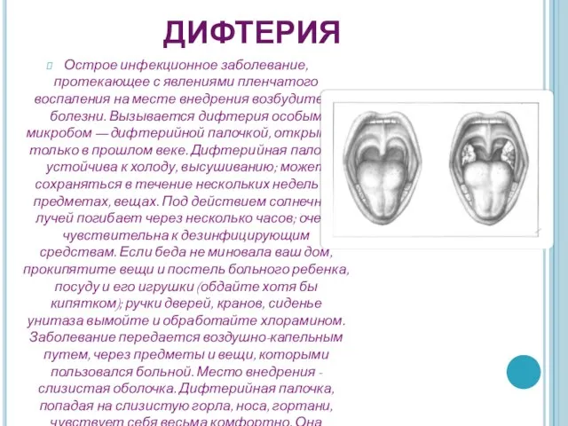 Дифтерия Острое инфекционное заболевание, протекающее с явлениями пленчатого воспаления на месте внедрения