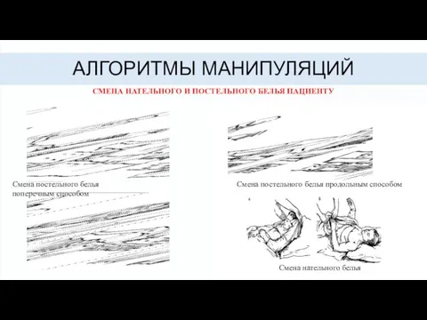 АЛГОРИТМЫ МАНИПУЛЯЦИЙ СМЕНА НАТЕЛЬНОГО И ПОСТЕЛЬНОГО БЕЛЬЯ ПАЦИЕНТУ Смена постельного белья продольным