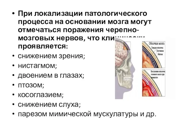 При локализации патологического процесса на основании мозга могут отмечаться поражения черепно-мозговых нервов,