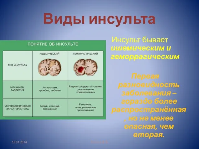 Виды инсульта Инсульт бывает ишемическим и геморрагическим Первая разновидность заболевания – гораздо