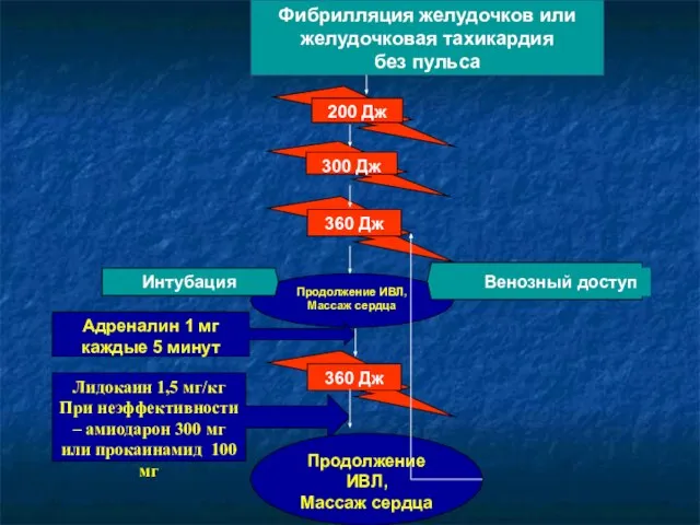 Фибрилляция желудочков или желудочковая тахикардия без пульса Продолжение ИВЛ, Массаж сердца Интубация