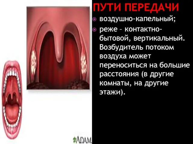 Пути передачи воздушно-капельный; реже – контактно-бытовой, вертикальный. Возбудитель потоком воздуха может переноситься