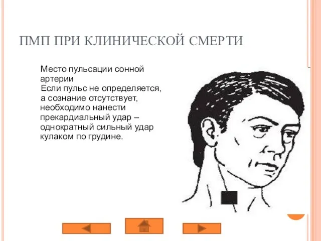 ПМП ПРИ КЛИНИЧЕСКОЙ СМЕРТИ Место пульсации сонной артерии Если пульс не определяется,