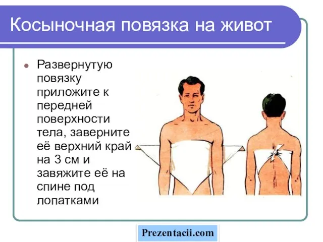 Презентация на тему Косыночная повязка