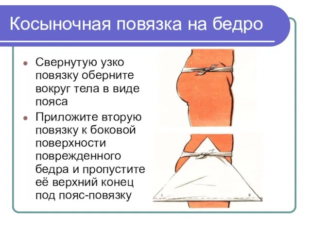 Косыночная повязка на бедро Свернутую узко повязку оберните вокруг тела в виде