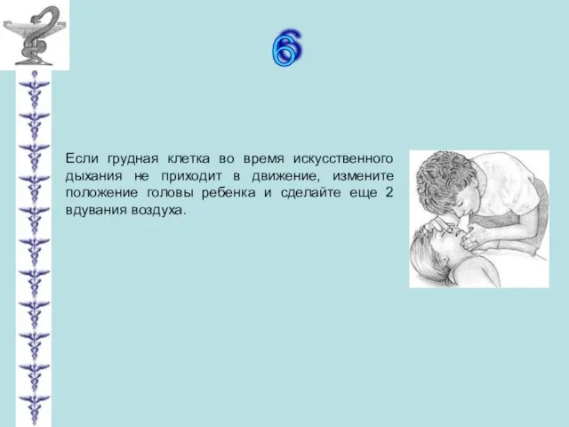 6 Если грудная клетка во время искусственного дыхания не приходит в движение,