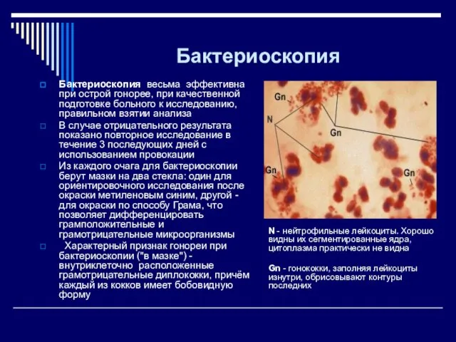 Бактериоскопия Бактериоскопия весьма эффективна при острой гонорее, при качественной подготовке больного к