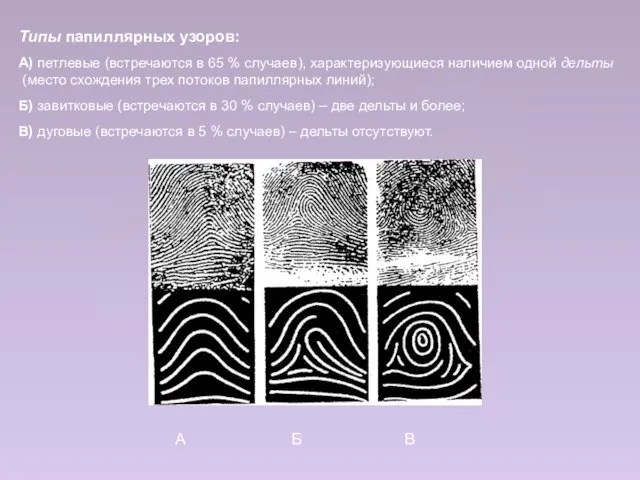 Типы папиллярных узоров: А) петлевые (встречаются в 65 % случаев), характеризующиеся наличием