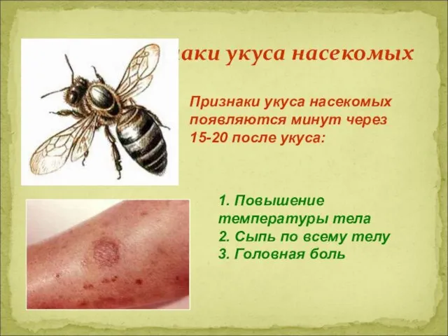 Первые признаки укуса насекомых Признаки укуса насекомых появляются минут через 15-20 после