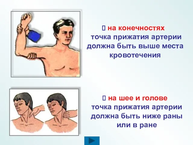 на шее и голове точка прижатия артерии должна быть ниже раны или