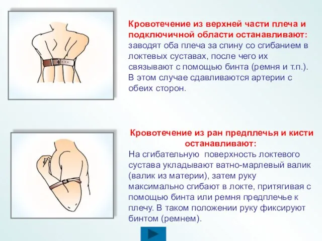 Кровотечение из верхней части плеча и подключичной области останавливают: заводят оба плеча