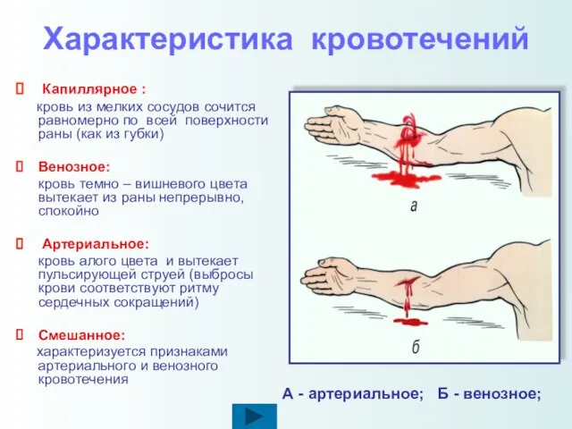 Характеристика кровотечений Капиллярное : кровь из мелких сосудов сочится равномерно по всей