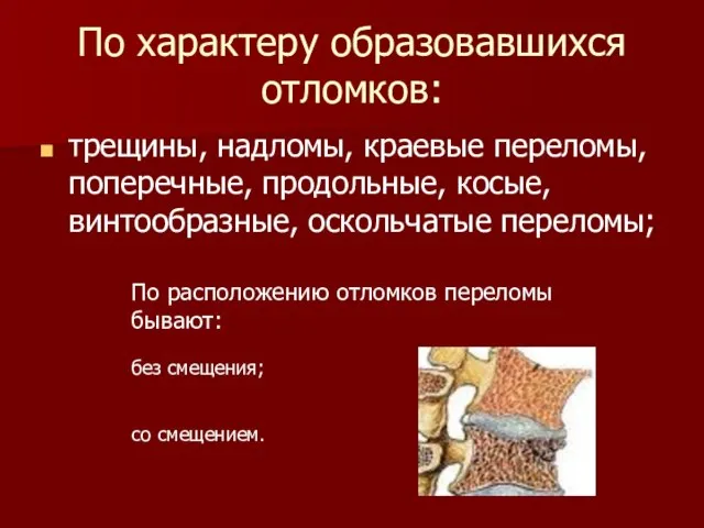 По характеру образовавшихся отломков: трещины, надломы, краевые переломы, поперечные, продольные, косые, винтообразные,