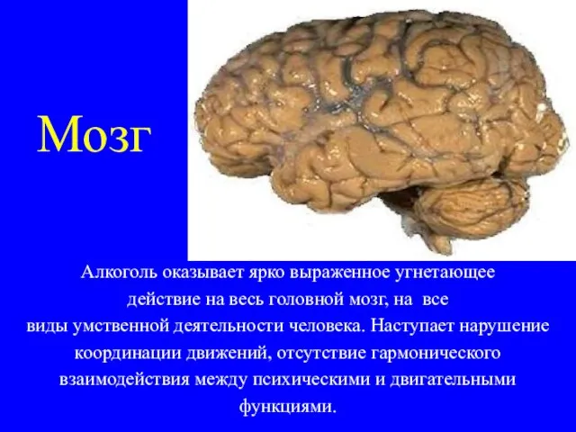 Мозг Алкоголь оказывает ярко выраженное угнетающее действие на весь головной мозг, на