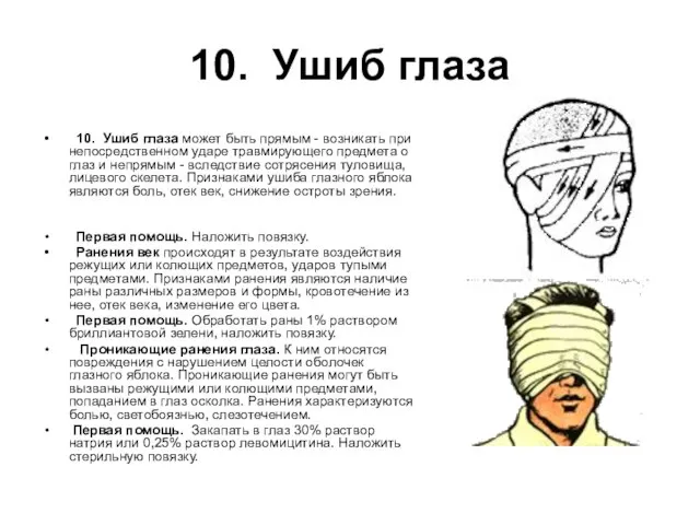 10. Ушиб глаза 10. Ушиб глаза может быть прямым - возникать при