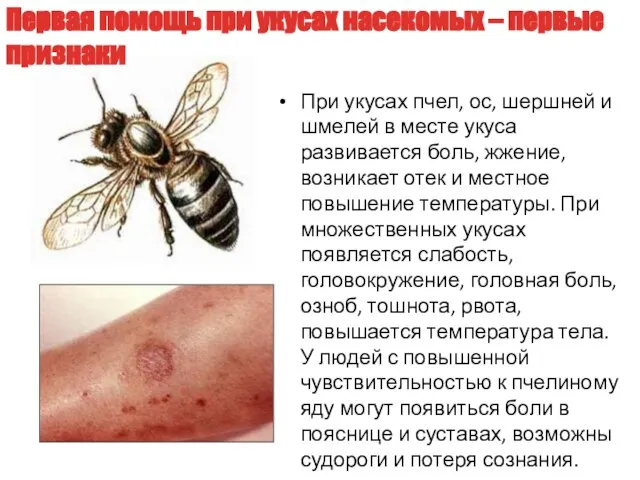 При укусах пчел, ос, шершней и шмелей в месте укуса развивается боль,