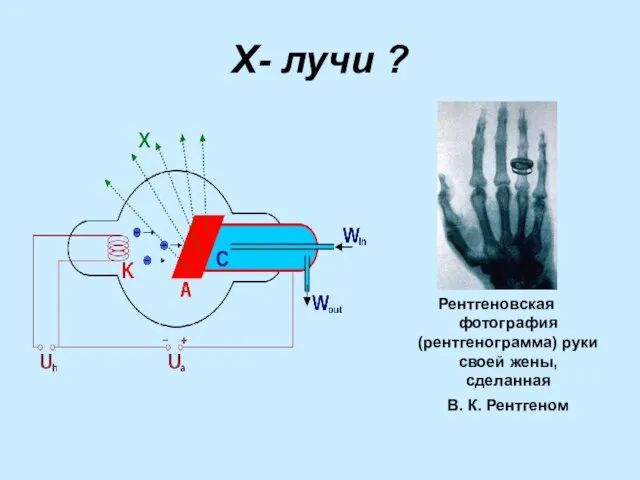 Х- лучи ? Рентгеновская фотография (рентгенограмма) руки своей жены, сделанная В. К. Рентгеном