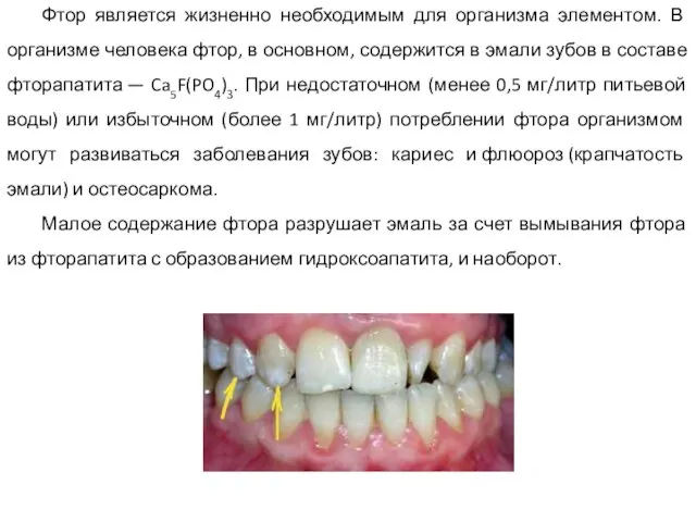 Фтор является жизненно необходимым для организма элементом. В организме человека фтор, в