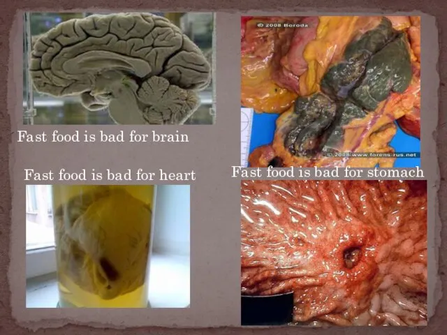 Fast food is bad for brain Fast food is bad for heart