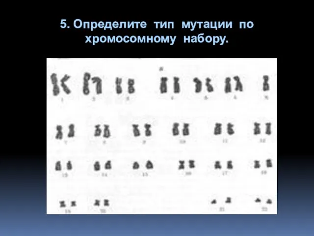 5. Определите тип мутации по хромосомному набору.