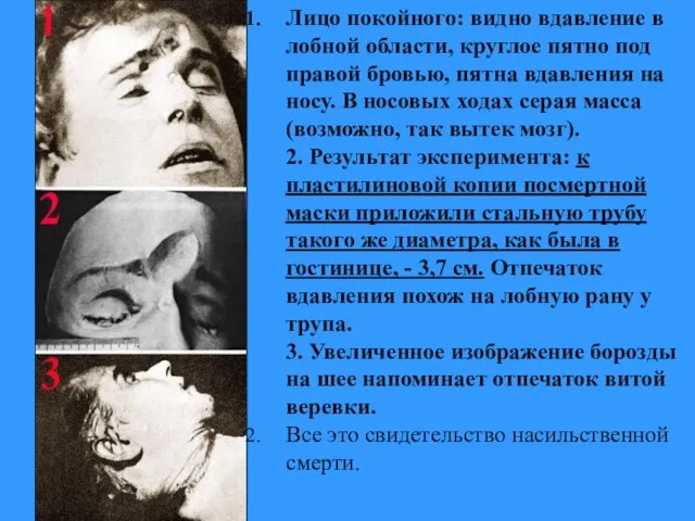 Лицо покойного: видно вдавление в лобной области, круглое пятно под правой бровью,