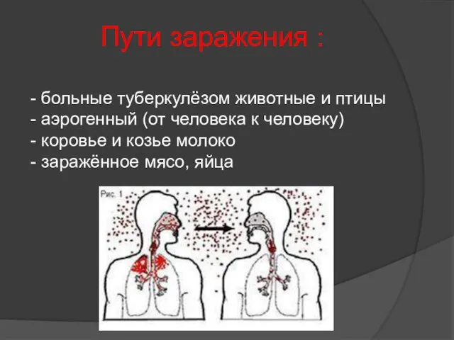 Пути заражения : больные туберкулёзом животные и птицы аэрогенный (от человека к