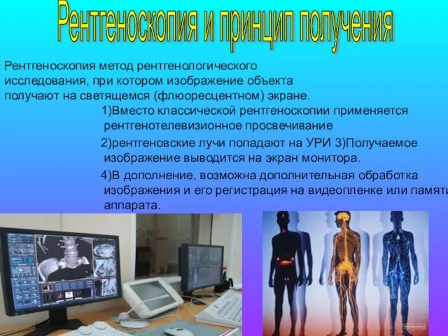 1)Вместо классической рентгеноскопии применяется рентгенотелевизионное просвечивание 2)рентгеновские лучи попадают на УРИ 3)Получаемое